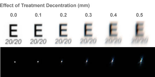 Treatment decentration leads to image degradation.